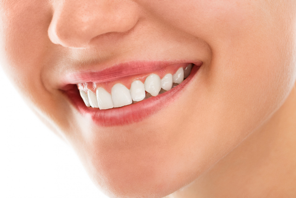 5 Cara Memutihkan Gigi secara Alami dengan Bahan Sederhana