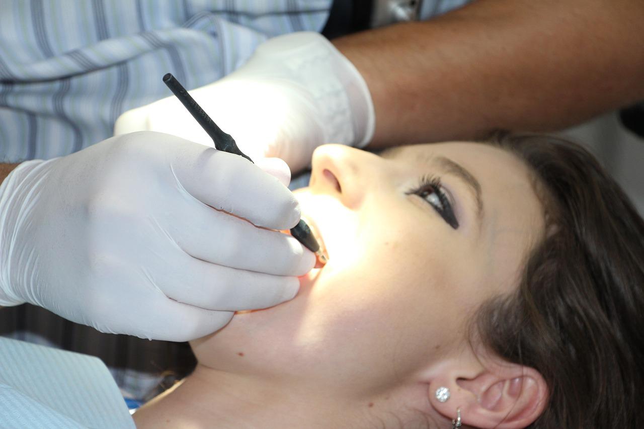 5 Manfaat Scaling Gigi untuk Kesehatan