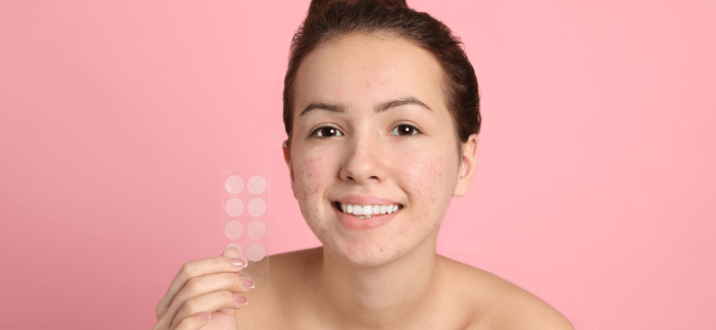 Acne Patch: Definisi, Manfaat dan Rekomendasi Acne Patch Terbaik