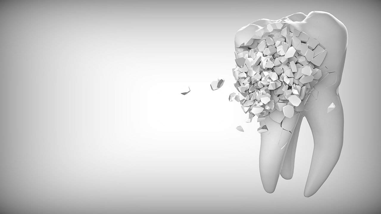 Begini Cara Alami Menyingkirkan Karang Gigi Efektif