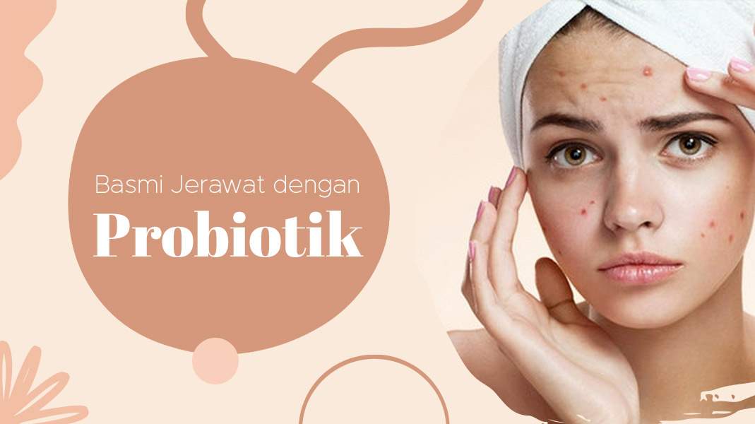 Berantas Jerawat dengan Konsumsi Probiotik