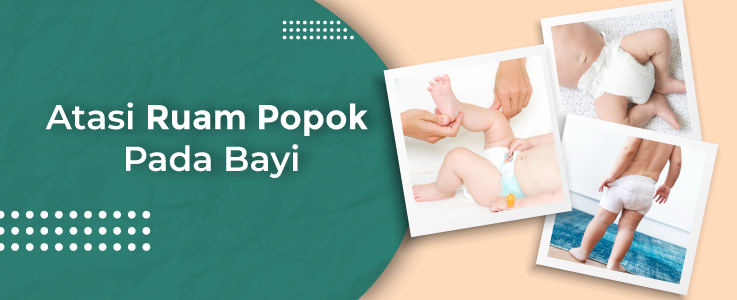 Ini Jurus Ampuh Atasi Ruam Popok Pada Bayi