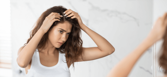Kenali Penyebab dan Cara Menghilangkan Ketombe dan Rambut Rontok