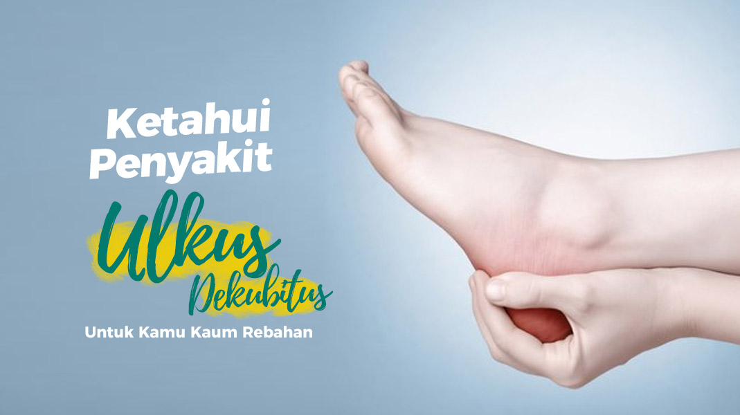 Ketahui Penyakit Ulkus Dekubitus Untuk Kamu Kaum Rebahan